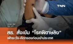 สธ. สั่งเข้ม “โรคฝีดาษลิง” จัดเตรียมทีมเฝ้าระวัง คัดกรองก่อนเข้าประเทศ