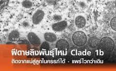 โรคฝีดาษลิงพันธุ์ใหม่ Clade 1b ติดจากแม่สู่ลูกในครรภ์ได้ - แพร่ไวกว่าเดิม