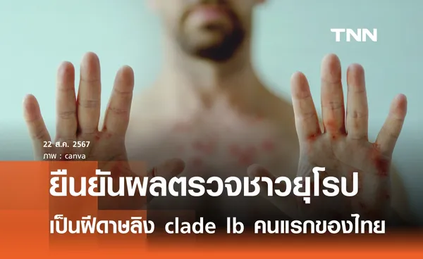 ยืนยันผลตรวจชาวยุโรปเป็นฝีดาษลิง clade Ib รายแรกของไทย 