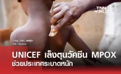 UNICEF เล็งตุนวัคซีน MPOX ช่วยประเทศระบาดหนัก