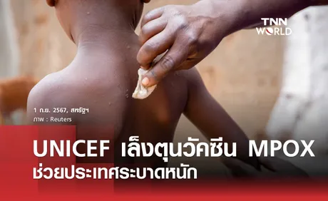 UNICEF เล็งตุนวัคซีน MPOX ช่วยประเทศระบาดหนัก