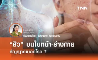 “สิว” บนใบหน้า-ร่างกาย  สัญญาณบอกโรค ?