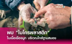 พบ ไมโครพลาสติก ในเนื้อเยื่อจมูกใกล้ฐานสมอง