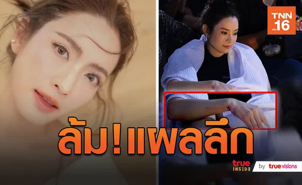 ลื่นล้มแผลลึก! แอฟ ทักษอร ประสบอุบัติเหตุในกองถ่าย  (มีคลิป)