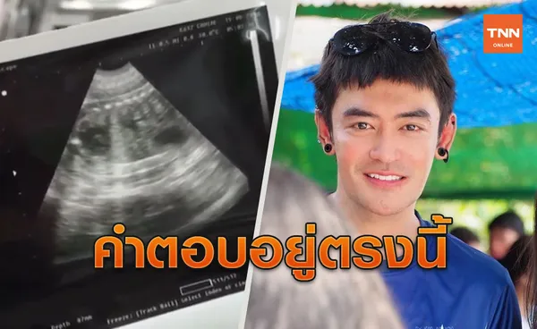 เติ้ล ธนพล ออกมาเคลียร์แล้ว คลิปอัลตราซาวด์ลูกแฝด ซุ่มแต่งงานตอนไหน?