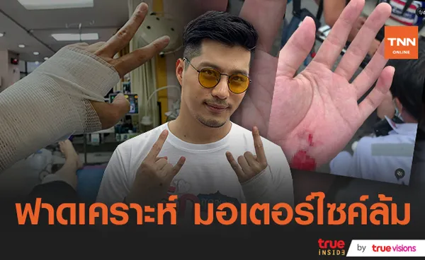 ตี๋ วิวิศน์ เผยปลอดภัยแล้ว หลังเกิดอุบัติเหตุรถมอเตอร์ไซค์ล้ม