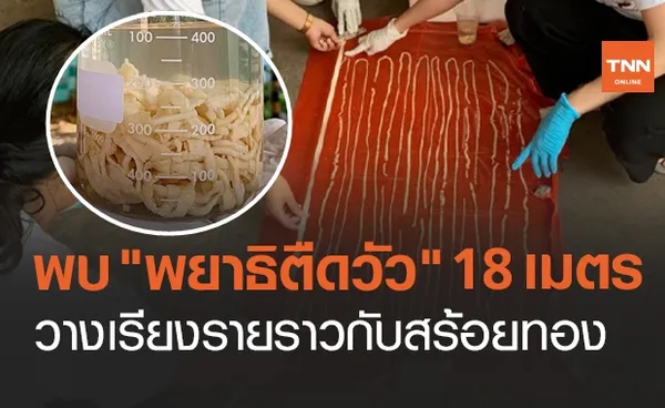 ผงะ! พบ พยาธิตืดวัว ยาวกว่า 18 เมตร วางเรียงรายราวกับสร้อยทอง