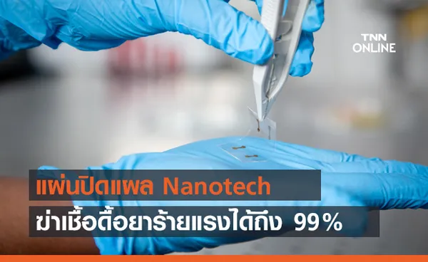 แผ่นปิดแผลนาโนเทค ฆ่าเชื้อดื้อยาร้ายแรงได้ถึง 99%