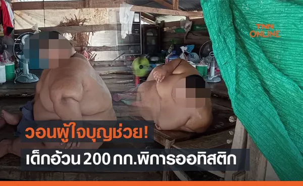 วอนผู้ใจบุญช่วย! เด็กวัย 13 ปี อ้วน 200 กก.พิการออทิสติก