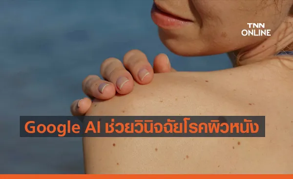 AI จาก Google ช่วยวินิจฉัยโรคผิวหนัง ผ่านรูปถ่ายของคุณ