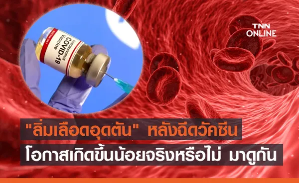 ไขข้อข้องใจ ลิ่มเลือดอุดตัน หลังฉีดวัคซีนโควิด โอกาสเกิดขึ้นน้อยจริงหรือ?