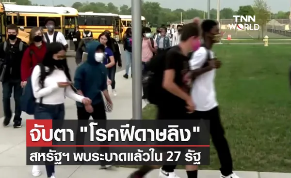 สหรัฐฯ จับตา โรคฝีดาษลิง ระบาดแล้ว 27 รัฐ