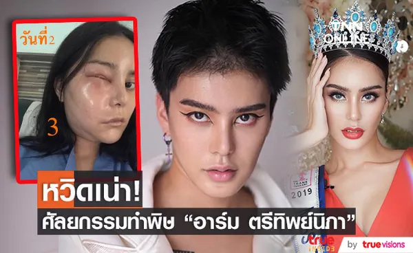 พิษศัลยกรรม! อาร์ม มิสทรานยูนิเวิร์สไทยแลนด์ หน้าบวมหวิดเน่า