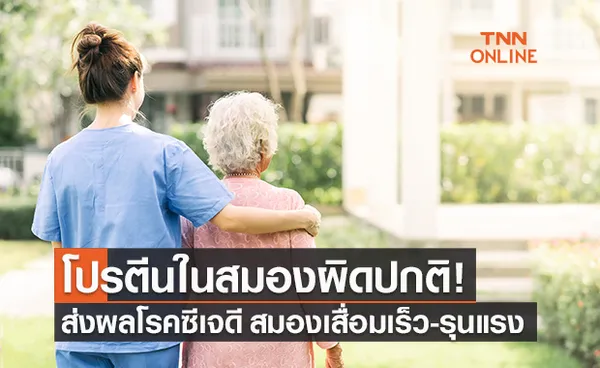 เตือนผู้สูงวัย! โปรตีนในสมองผิดปกติ ส่งผลโรคซีเจดี สมองเสื่อมรวดเร็วและรุนแรง