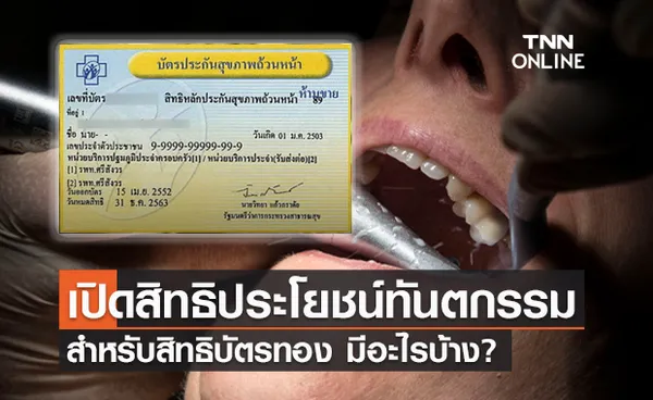 เปิดสิทธิประโยชน์ ทำฟัน บัตรทอง เพิ่มคุณภาพชีวิตทุกกลุ่มวัย