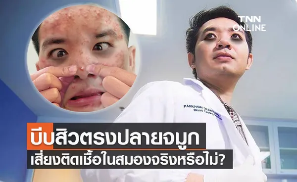 หมอแล็บแพนด้า ไขข้อสงสัย! บีบสิวปลายจมูก เสี่ยงติดเชื้อในสมองจริงหรือไม่?