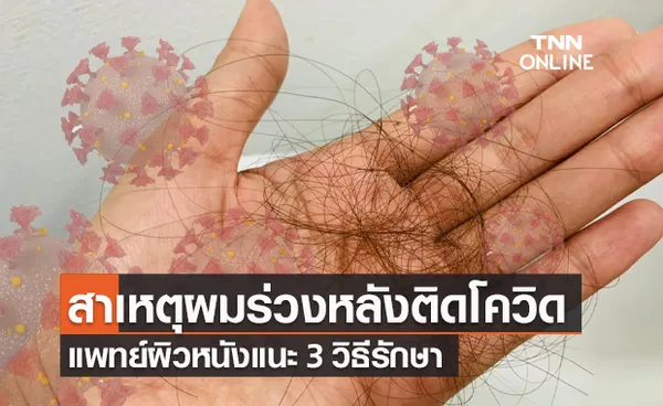 แพทย์ผิวหนัง ไขสาเหตุภาวะ ผมร่วง หลังการติดเชื้อโควิด-19 แนะ 3 วิธีรักษา