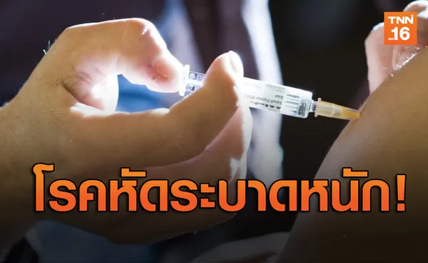 คองโกป่วน! โรคหัดระบาดรุนแรง คร่าชีวิตกว่า1,500ราย